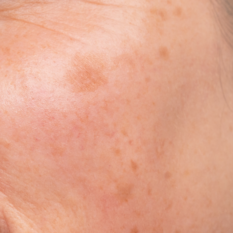 beaut-pacifique-brown-pigment-equalizer-tyrostase-pigmentcreme image 3