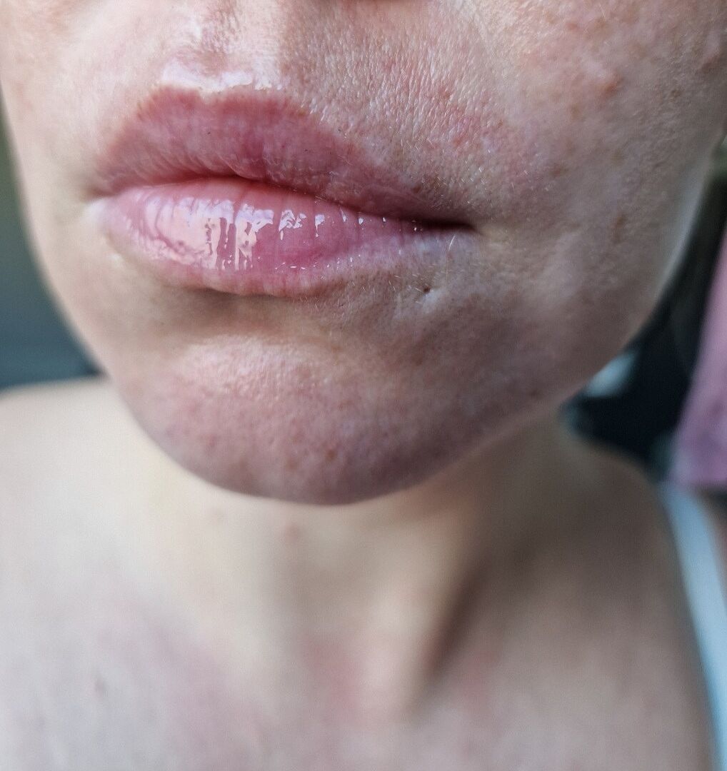 Endlich keine rissigen Lippen mehr