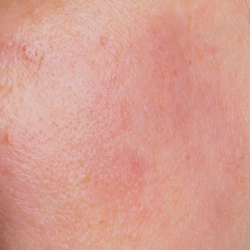 beaut-pacifique-clinical-anti-redness-cream image 2